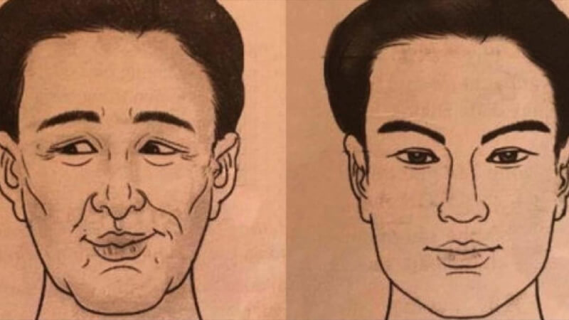 Tướng khuôn mặt