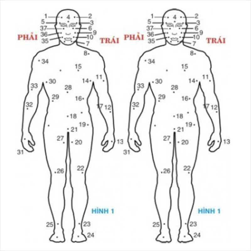 Tướng nốt ruồi 